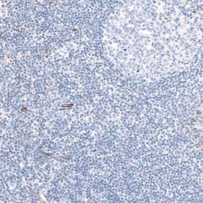 Immunohistochemistry-Paraffin: EFHD1 Antibody [NBP2-33281]