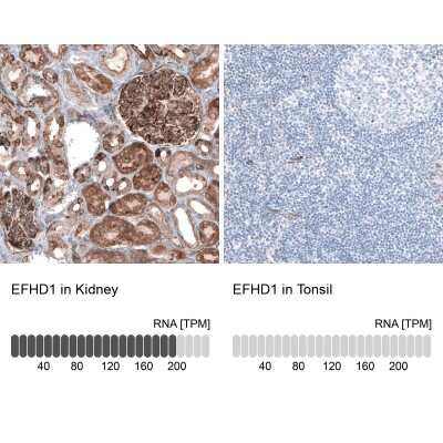 Immunohistochemistry-Paraffin: EFHD1 Antibody [NBP2-33281]