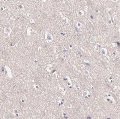 Immunohistochemistry-Paraffin: EGF-L6 Antibody [NBP2-33282]