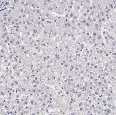 Immunohistochemistry-Paraffin: EGF-L6 Antibody [NBP2-33282]