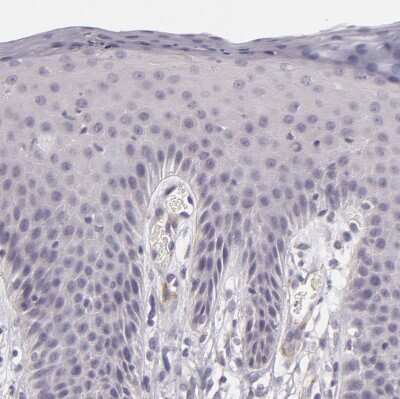 Immunohistochemistry-Paraffin: EGF-L6 Antibody [NBP2-33282]