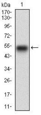 Western Blot: EGFR Antibody (5E10D3)BSA Free [NBP2-37326]