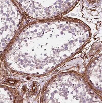 Immunohistochemistry-Paraffin: EGFL8 Antibody [NBP2-49327]