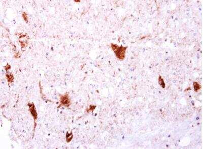 Immunohistochemistry-Paraffin: EGFLAM Antibody [NBP2-14941]