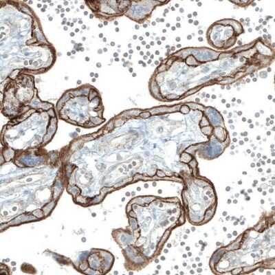 Immunohistochemistry-Paraffin: EGFR Antibody (CL0815) [NBP2-52952]