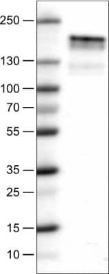 Western Blot: EGFR Antibody (CL0815) [NBP2-52952]