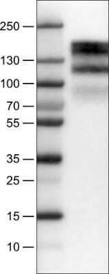 Western Blot: EGFR Antibody (CL0822) [NBP2-52953]