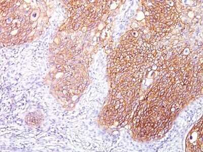 Immunohistochemistry-Paraffin: EGFR Antibody (GFR/1667) - Azide and BSA Free [NBP2-54310]