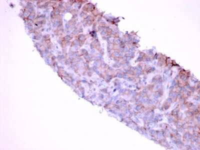 Immunohistochemistry-Paraffin: EGFR Antibody (GFR/1667) [NBP2-53346]