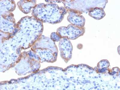 Immunohistochemistry-Paraffin: EGFR Antibody (GFR/1667) [NBP2-53346]