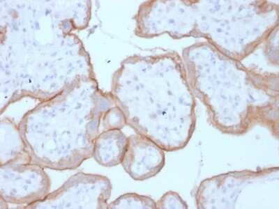 Immunohistochemistry-Paraffin: EGFR Antibody (GFR/1708) - Azide and BSA Free [NBP2-54330]