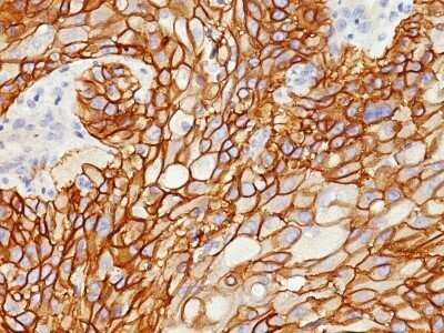 Immunohistochemistry-Paraffin: EGFR Antibody (GFR/1708) [NBP2-53198]