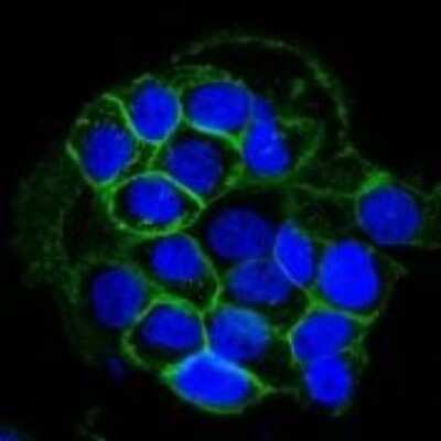 Immunocytochemistry/ Immunofluorescence: EGFR Antibody (GFR450) [NBP2-29440]