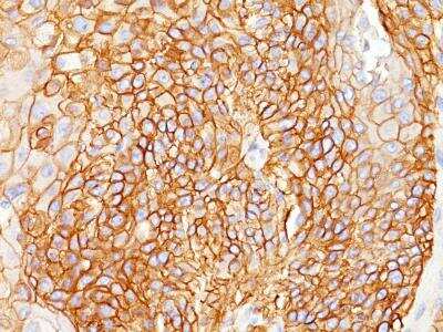 Immunohistochemistry-Paraffin: EGFR Antibody (GFR450) [NBP2-29440]