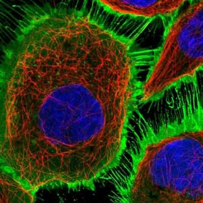 Immunocytochemistry/ Immunofluorescence: EGFR Antibody [NBP1-84814]