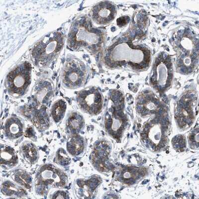 Immunohistochemistry-Paraffin: EGFR Antibody [NBP1-84814]