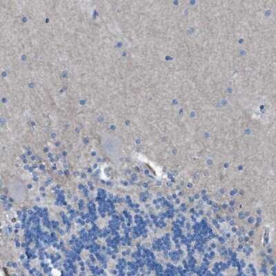 Immunohistochemistry-Paraffin: EGFR Antibody [NBP1-84814]
