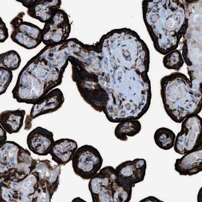 Immunohistochemistry-Paraffin: EGFR Antibody [NBP1-84814]