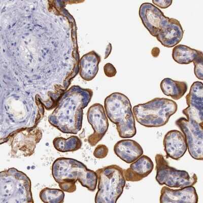 Immunohistochemistry-Paraffin: EGFR Antibody [NBP1-84815]