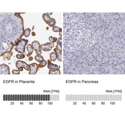 Immunohistochemistry-Paraffin: EGFR Antibody [NBP1-84815]