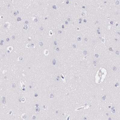 Immunohistochemistry-Paraffin: EGFR Antibody [NBP1-84815]