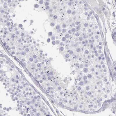 Immunohistochemistry-Paraffin: EGFR Antibody [NBP1-84815]