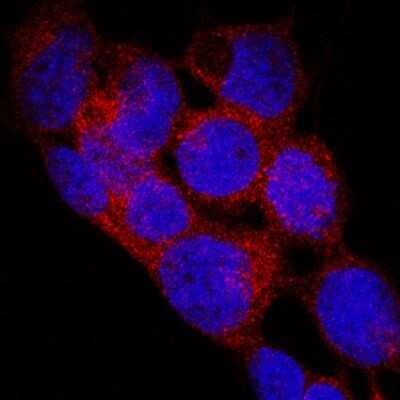 Immunocytochemistry/ Immunofluorescence: EGLN1/PHD2 Antibody (2445B) - Azide and BSA Free [NBP2-80713]