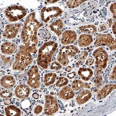 Immunohistochemistry-Paraffin: EGLN1/PHD2 Antibody (2445D) - BSA Free [NBP2-78782]