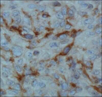 Immunohistochemistry: EGLN1/PHD2 Antibody (366G/76/3) [NBP1-30328]