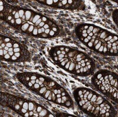 Immunohistochemistry-Paraffin: EGLN1/PHD2 Antibody [NBP2-54676]