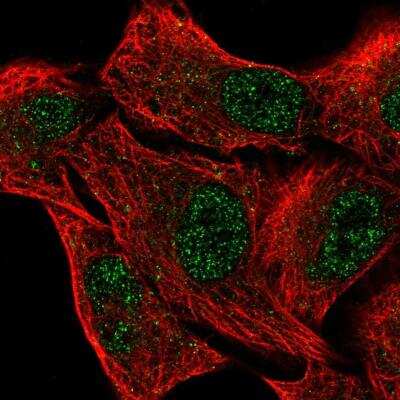 Immunocytochemistry/ Immunofluorescence: EGLN2/PHD1 Antibody [NBP2-76551]
