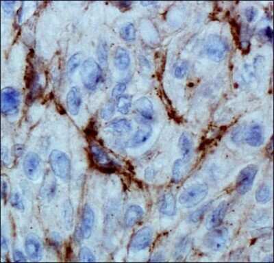 Immunohistochemistry: EGLN3/PHD3 Antibody (EG188e/d5) - Azide and BSA Free [NBP2-80715]