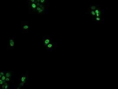 Immunocytochemistry/ Immunofluorescence: EGR2 Antibody (OTI1B12) - Azide and BSA Free [NBP2-70624]