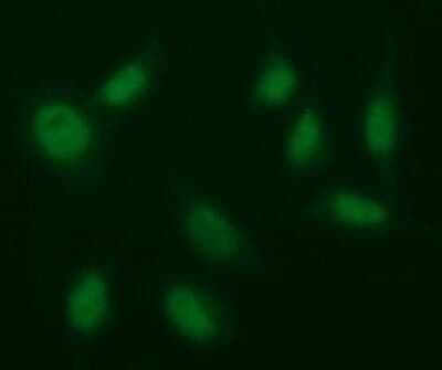 Immunocytochemistry/ Immunofluorescence: EGR2 Antibody (OTI1B12) - Azide and BSA Free [NBP2-70624]