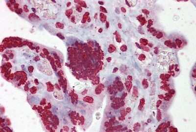 Immunohistochemistry: EGR3 Antibody [NBP2-82978]