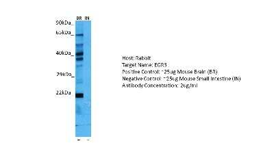 Western Blot: EGR3 Antibody [NBP2-82982]
