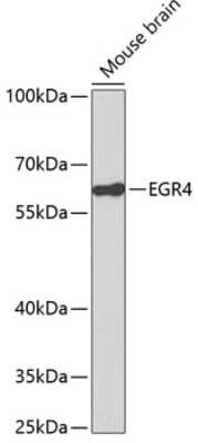 Immunohistochemistry-Paraffin: EGR4 Antibody - Azide and BSA Free [NBP2-92774]