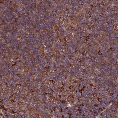 Immunohistochemistry-Paraffin: EHBP1L1 Antibody [NBP1-90496]