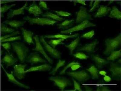 Immunocytochemistry/ Immunofluorescence: EHD2 Antibody (1F1) [H00030846-M02]