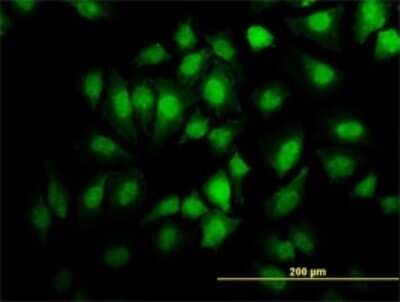Immunocytochemistry/ Immunofluorescence: EHD2 Antibody (2D8) [H00030846-M01]