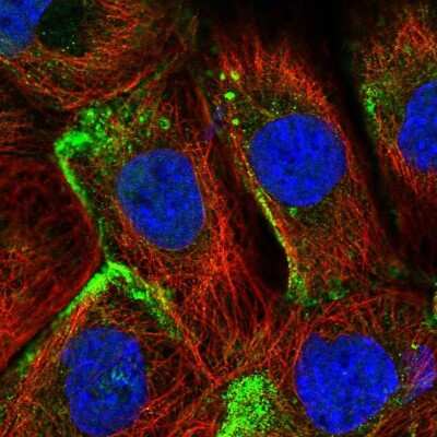 Immunocytochemistry/ Immunofluorescence: EHD2 Antibody [NBP2-33283]