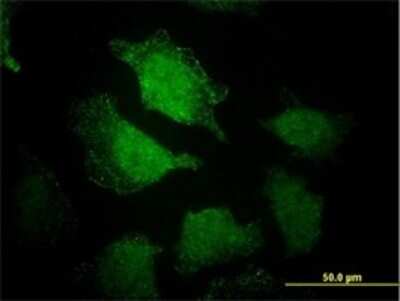 Immunocytochemistry/ Immunofluorescence: EHD3 Antibody (4B7) [H00030845-M01]