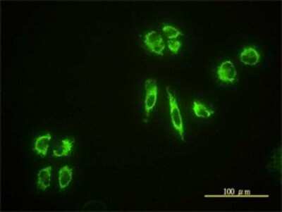 Immunocytochemistry/ Immunofluorescence: EHD4 Antibody (1B8) [H00030844-M01]