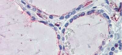 Immunohistochemistry: EHD4 Antibody [NBP1-54873]
