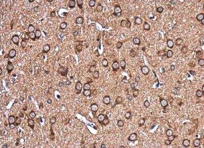 Immunohistochemistry-Paraffin: EHD4 Antibody [NBP2-16287]