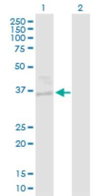 Western Blot: EHF Antibody [H00026298-D01P]