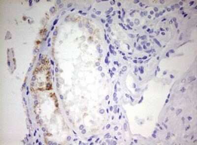 Immunohistochemistry: EHHADH Antibody (OTI2C4) [NBP2-46487]