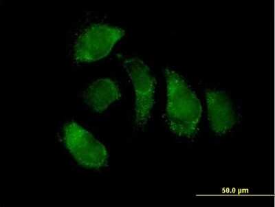 Immunocytochemistry/ Immunofluorescence: EHHADH Antibody [H00001962-B01P]
