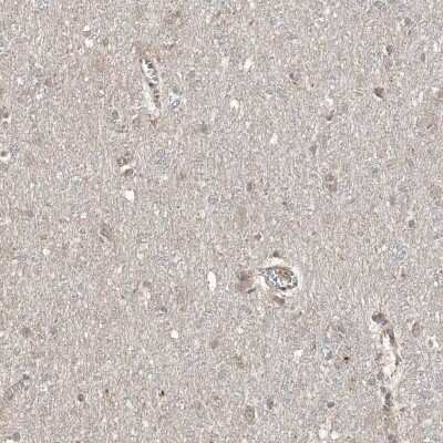Immunohistochemistry-Paraffin: EHHADH Antibody [NBP1-84915]