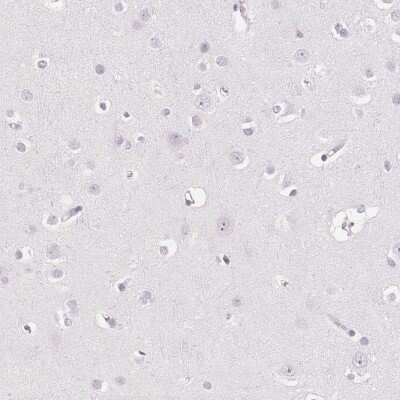 Immunohistochemistry-Paraffin: EHHADH Antibody [NBP2-48754]